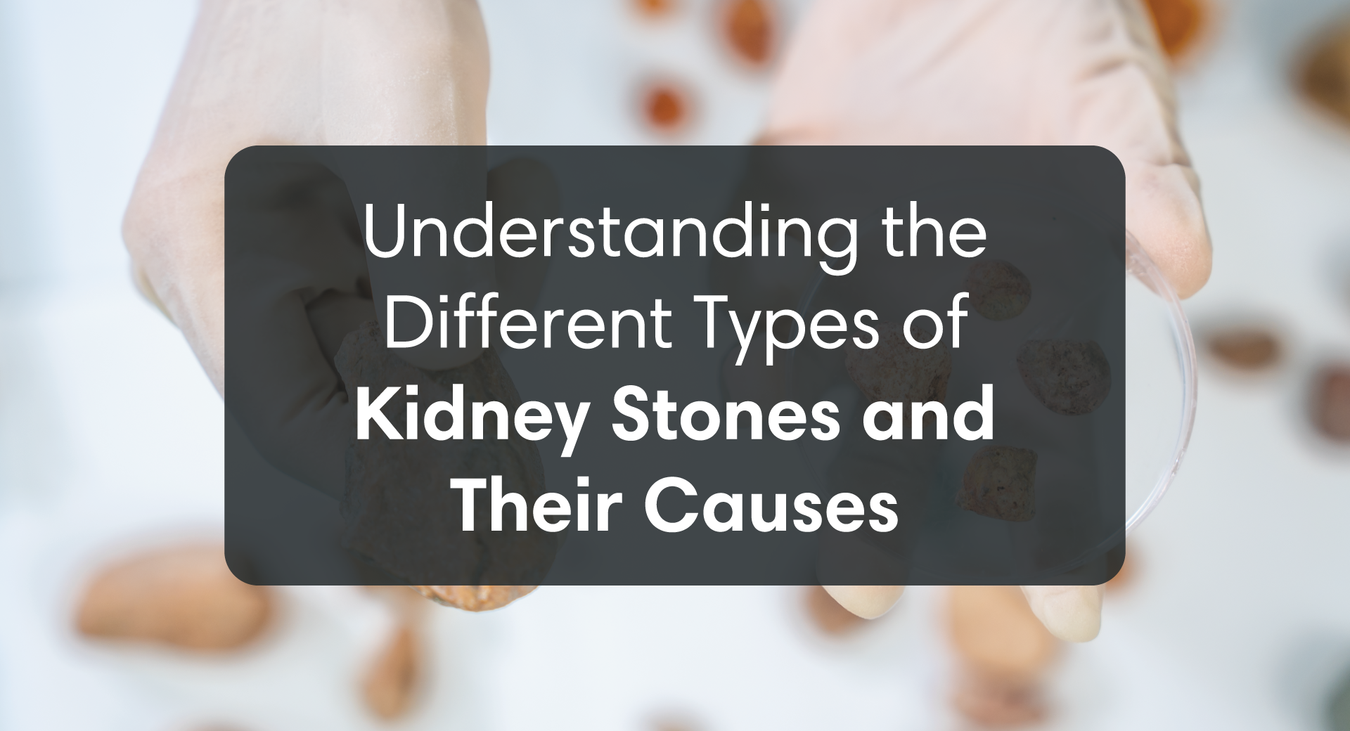 Understanding The Different Types of Kidney Stones and Their Causes