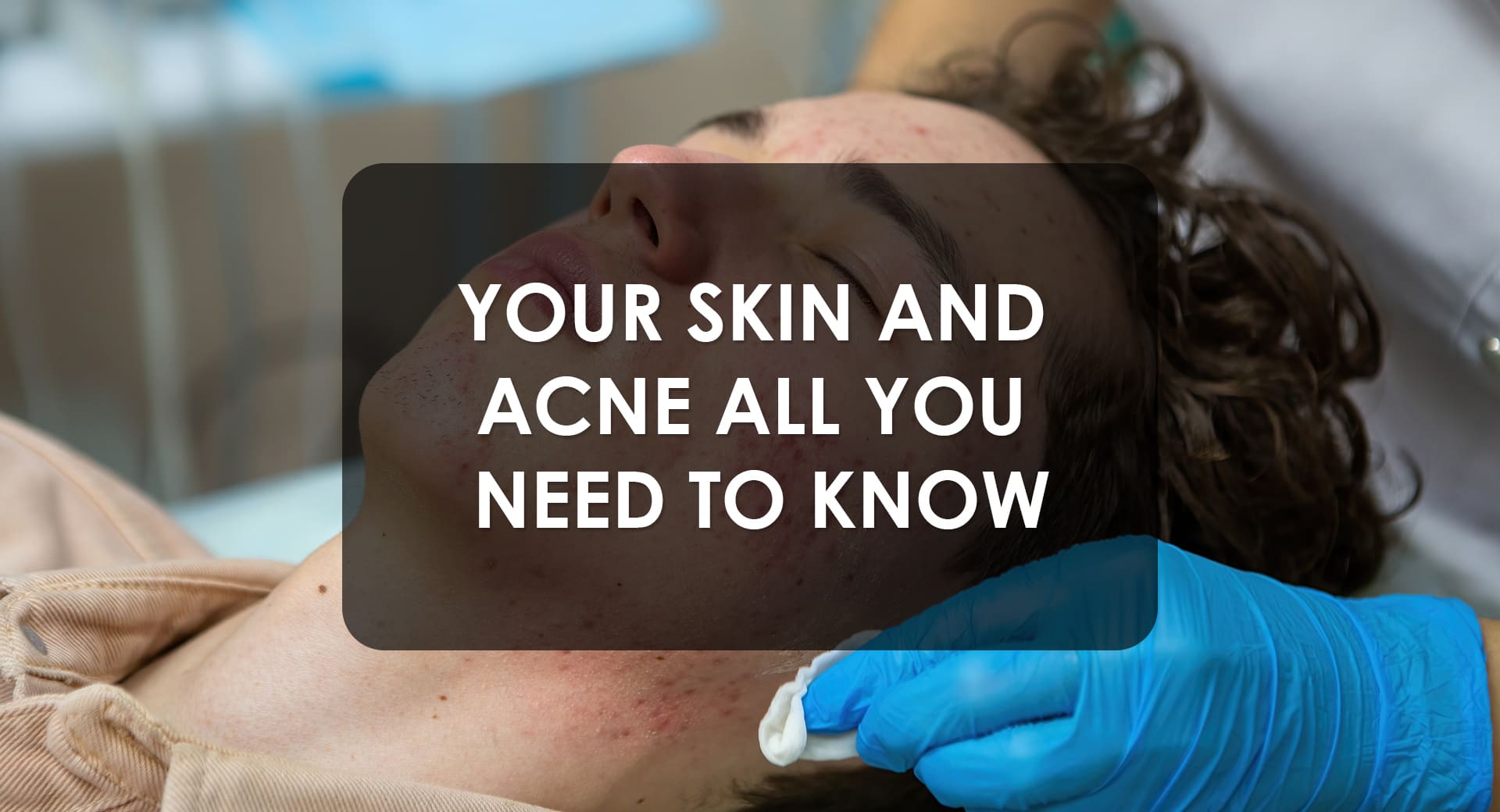 Your Skin And Acne