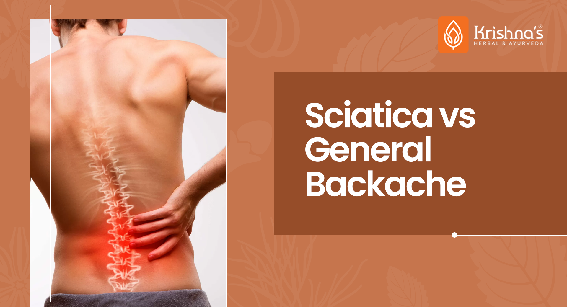 Difference Between Sciatica and General Backache: What to Know